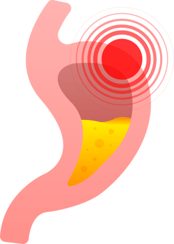 Human stomach. Healthy and unhealthy. Digestive system anatomy. stock illustration. png