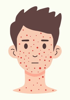 Illustration of a man's neck and face covered in red spots vector