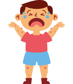 A boy with a rash on his face and arms png