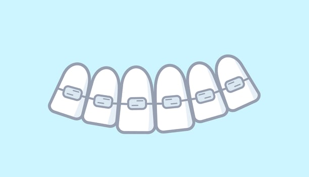 Dental braces doodle icon. illustration of dental care, dentistry, sketch of teeth. vector