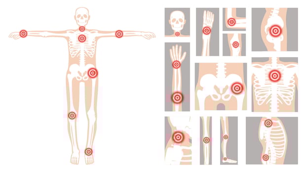 Human figure highlighting common pain points linked to rheumatic disorders, including joints and skeletal regions in a clear, educational format vector