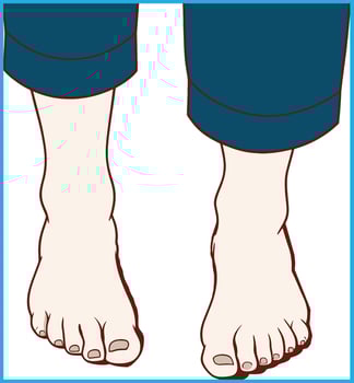women leg pain too much vector