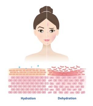 Comparison of healthy and dry skin on woman face illustration. Cross section of skin barrier layer hydration, attract, absorb water, moisture and the skin lacks water in the uppermost layer. vector