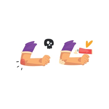 Elbow injury, first aid and treatment Illustration isolated on a white background vector
