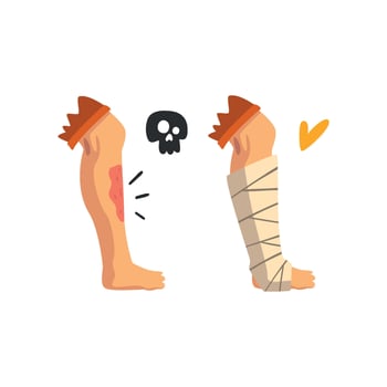 Wounded leg, physical injury, bandaged leg, first aid and treatment Illustration on a white background vector