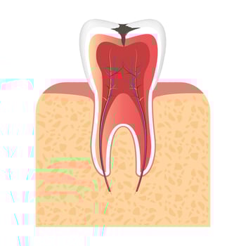 Caries, mouth pain, toothache. Dental clinic logo vector