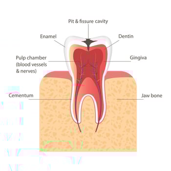 Dentistry concept. Tooth model. Stages of tooth decay vector