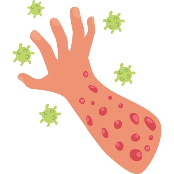 monkeypox virus hands png