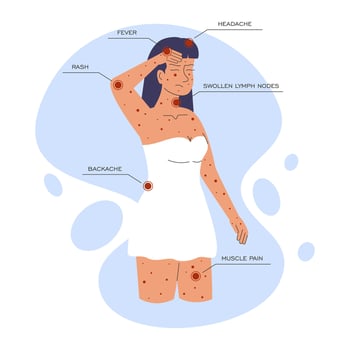 Monkeypox virus symptoms illustration. Woman with symptoms of Monkeypox vector