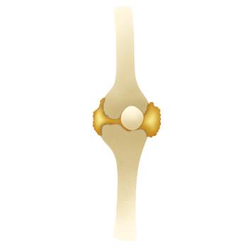Gout disease illustration png
