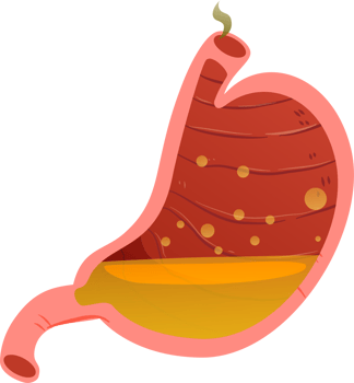 Illustrations of Stomach Health and Disorders png