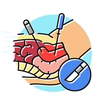 gynecologic laparoscopy color icon illustration vector