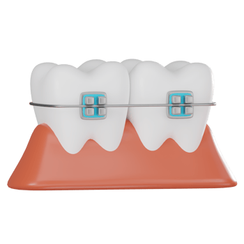 3D Render Teeth with Braces on Gums Illustration Icon png