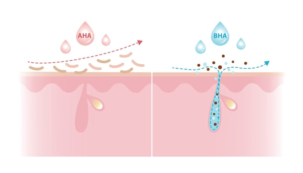 Alpha Hydroxy Acids and Beta Hydroxy Acids characteristics illustration on white background. AHA exfoliate the surface skin and water soluble. BHA penetrate deep into the pore and oil soluble. vector