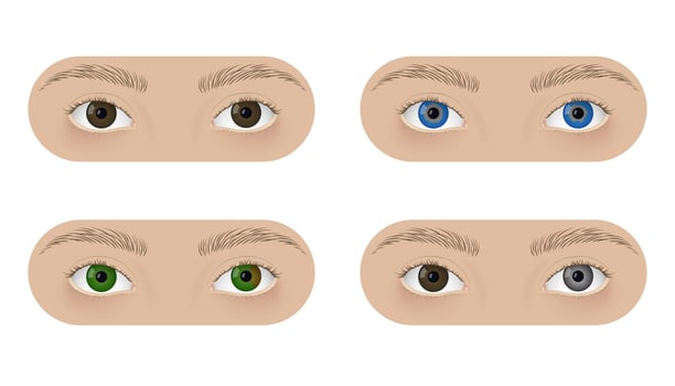 Realistic human eyes with heterochromia. Different colors irises, normal, central, segmental and complete. vector