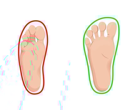 Barefoot shoes impacts on feet infographic. Compare comfortable and orthopedic footwear with regular. vector