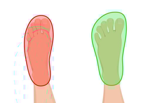 Barefoot and regular shoes infographic. Feet disease, hallux valgus, pain, toe deformity and flatfoot. vector