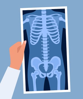 Human skeleton chest x ray image. Torso roentgen shot. Medical analyzing. Anatomical bone medicine laboratory radial scan picture. Roentgen shot in doctors hand. illustration. vector
