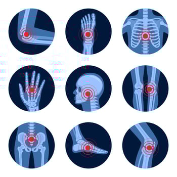 Parts of human body on x ray view. Different x-rays shot of human body parts with skeleton pain points. Chronic anatomy body injury in circle shape. illustration. vector