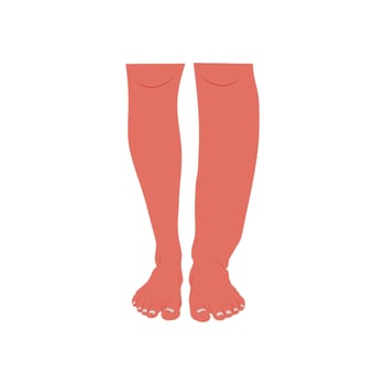 Legs Swelling, Cardiovascular Disease Illustration Icon vector