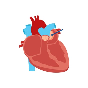 Blood Cancer, Cardiovascular Disease Illustration Icon vector