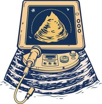 Ultrasound machine illustration in vintage style vector