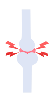 Joint pain causing inflammation and discomfort in bones png