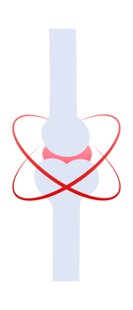 Joint inflammation causing pain highlighted with red circles in a medical illustration png
