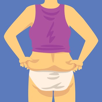Part of Female Overweight Body, Human Figure After Weight Loss, Back View, Obesity and Unhealthy Eating Problems Illustration vector