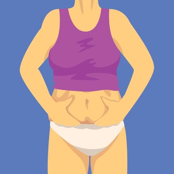 Part of Female Body, Woman Clamping Fold of Belly with Her Hands, Front View, Human Figure After Weight Loss, Obesity and Unhealthy Eating Problems Illustration vector