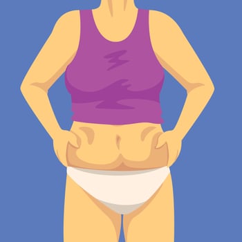 Part of Female Body, Woman Clamping Fold of Fat Belly with Both Hands, Human Figure After Weight Loss, Obesity and Unhealthy Eating Problems Illustration vector