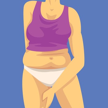 Part of Female Body with Fat Belly, Woman Clamping Fold of Hip with Her Hand, Human Figure After Weight Loss, Obesity and Unhealthy Eating Problems Illustration vector