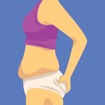 Part of Female Body with Fat Belly, Human Figure After Weight Loss, Side View, Obesity and Unhealthy Eating Problems Illustration vector