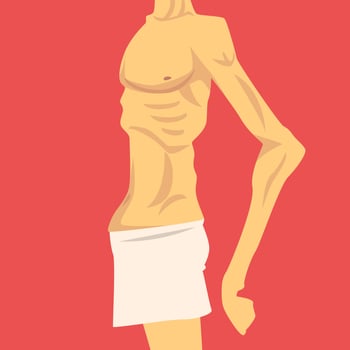 Male Torso with Short Weight and Sagging Belly, Human Body After Weight Loss, Side View, Obesity and Unhealthy Eating Problems Illustration vector