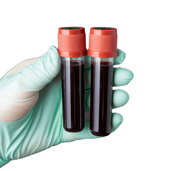 Blood Sample Collection in Laboratory Tubes with Transparent Background png