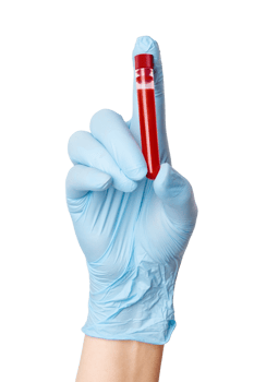 Hand in medical gloves holding a test tube with blood . Medical testing, laboratory analysis, healthcare diagnostics. png