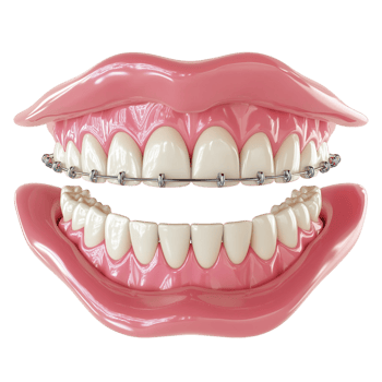 teeth braces on a transparent background png