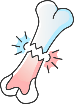 Illustration of a bone fracture png