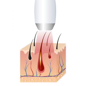 IPL HAIR REMOVAL vector