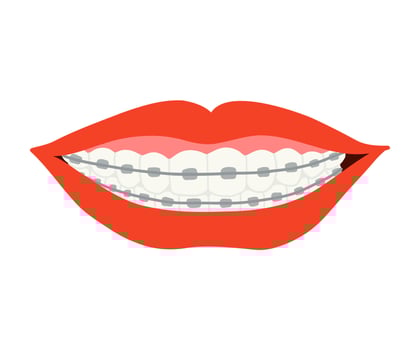 A smile with braces is drawn in a flat style. Healthy smile, braces, lips. Hand drawn illustration. vector