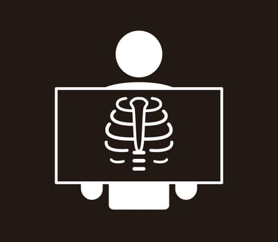 Human organ rib cage flat icon, x-ray illustration vector