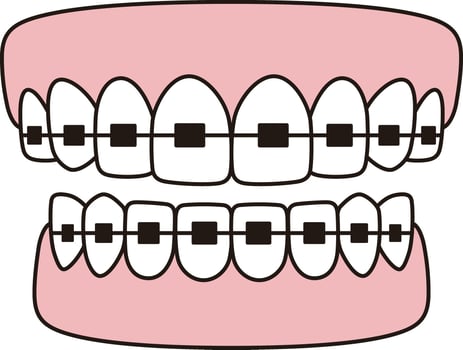 Teeth braces icons, flat illustration vector