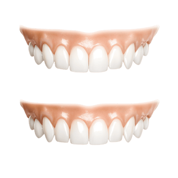 Before and After White Teeth for Dentist Advertisement on transparent background png