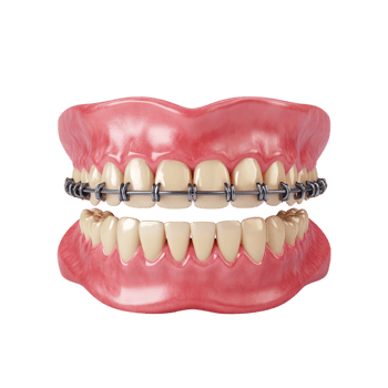 teeth braces on a transparent background png