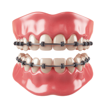 teeth braces on a transparent background png