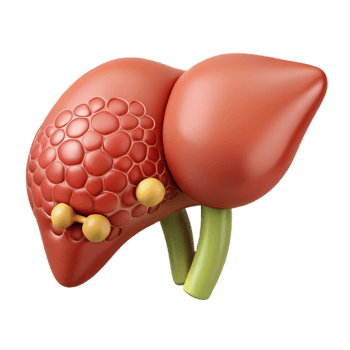 3D Illustration of Human Liver with Tumours png