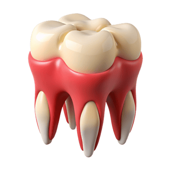 visual of a tooth with pink gum coverage, png