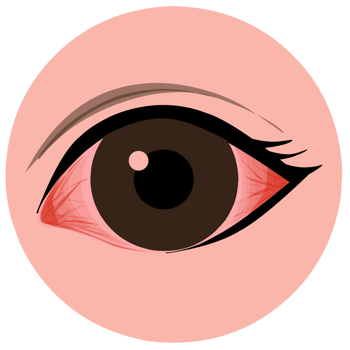 Conjunctivitis eyes illustration png