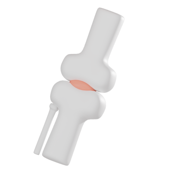 3D render, Knee Joint for Orthopedic and Medical Visualization, Icon Illustration png