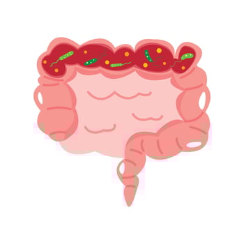 vibrio cholera bacteria infection disease concept. intestine vector